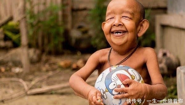 男孩|印度4岁男孩面容如90岁老翁,3个月大牙齿长全