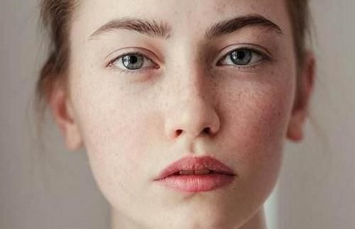 这3种食物女人要少吃，面部容易长斑，衰老快