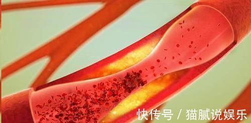 素问玄机原病式|血脂高的人,早晚坚持“1件事”,血管年轻20岁,离长寿又进一步
