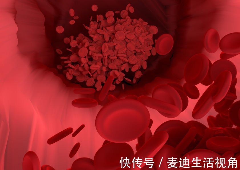血液|血脂高,身体会出现3个“信号”,少吃“2果”,多做“3事”,血液清澈