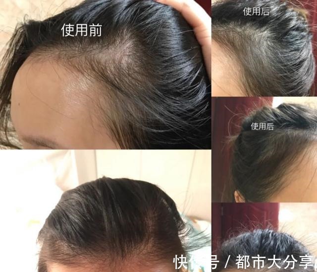 小马甲|一款“默默无闻”的洗发水,效果不输大牌,网友用完头发更好了!