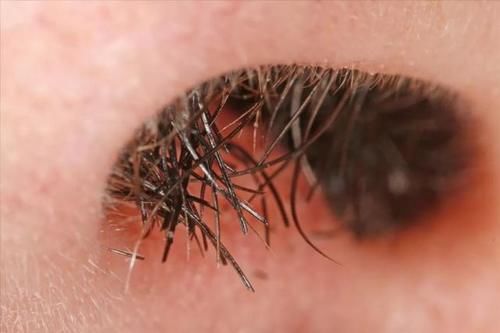 毛发|“鼻毛变白”是衰老前兆吗?其实还有其他可能,男性朋友多注意