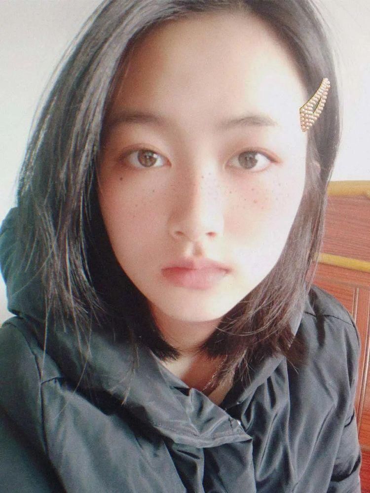 视力|眼睛近视模糊了，不手术裸眼视力还能恢复吗