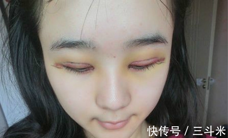 美丽的眼睛 手术割了双眼皮的人,老了后会变成什么样?现在知道还不晚!