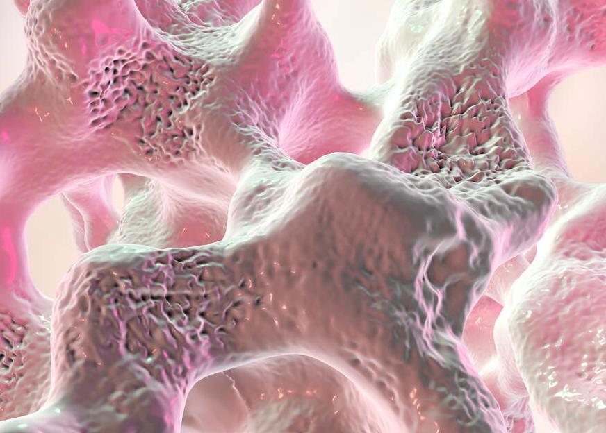 喝牛奶能预防骨质疏松?骨科大夫:大错特错,真正有用的常做3事