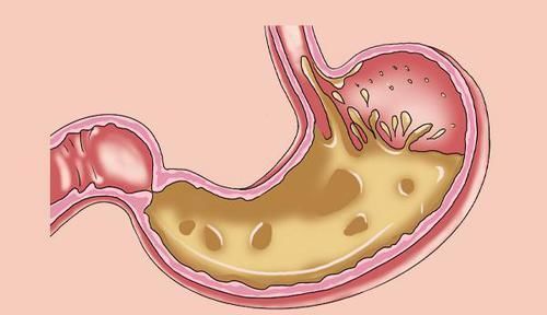脾胃|陈皮有“良配”,经常拿来一起泡水喝,养肝排毒,调血脂滋养脾胃