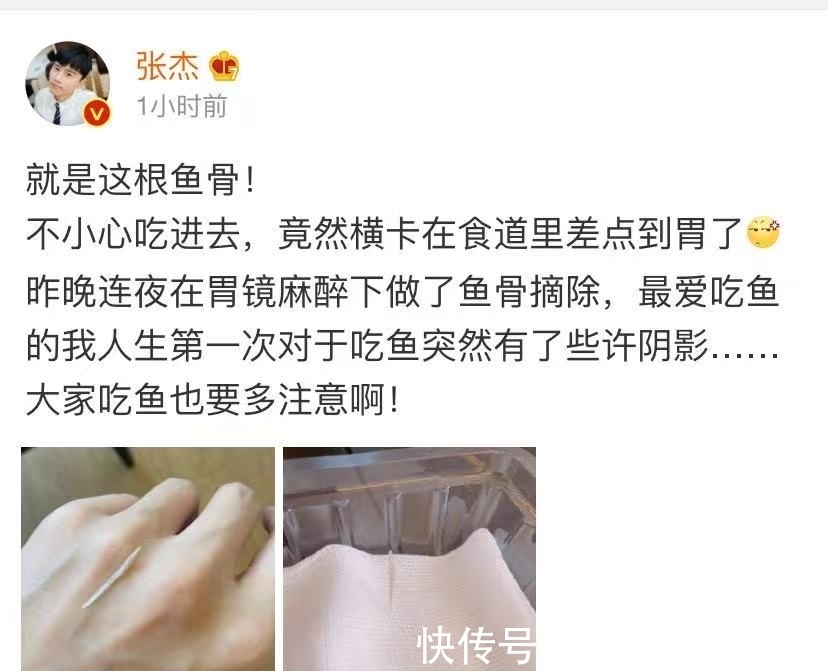 節(jié)目錄制|張杰自曝吃魚時被魚刺卡到食管，很危險還看醫(yī)生了，粉絲們操碎心