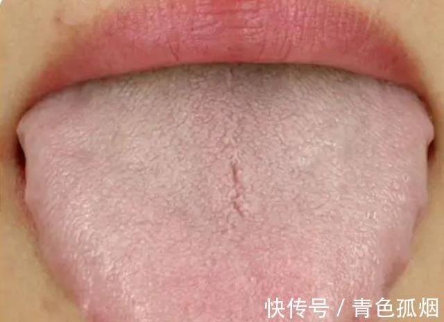 芒果性|湿气重的人,夏季饮食该注意什么?医生说出实情,别不放在心上