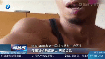 小蟲子|警惕！戶外活動遇上這蟲，要小心！