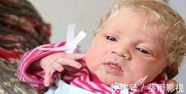 小孩|为什么黑人父母会生出纯白宝宝,不明基因突变