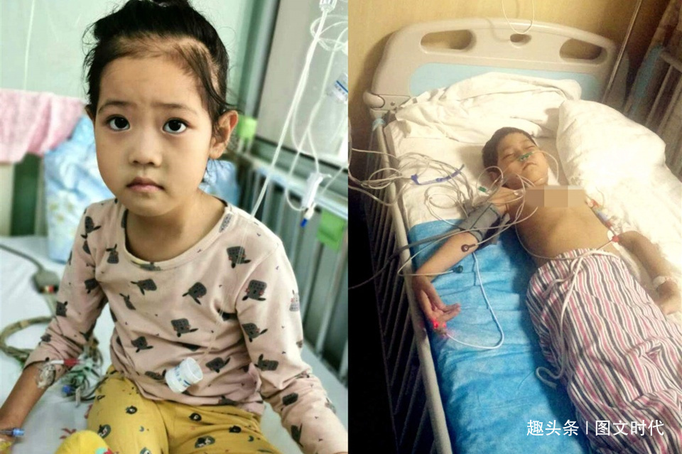 程程|6岁女童鼻子突然红肿，送医查出罕见肿瘤，妈妈含泪打掉腹中胎儿