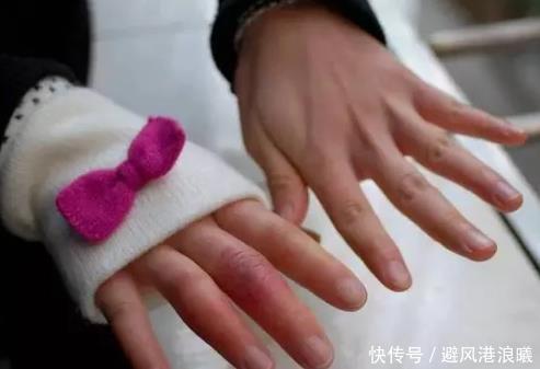 皮肤溃疡|“冬吃萝卜,夏吃姜”,白萝卜还有一个小偏方,早看早受益