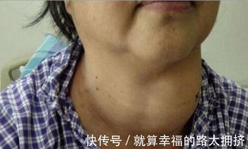 冷水果|橘子营养丰富好处多,吃完橘子之后1小时,3种食物不能吃