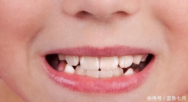 無論男女,如果嘴上出現(xiàn)了“它”,可能是體內(nèi)免疫力要下降了