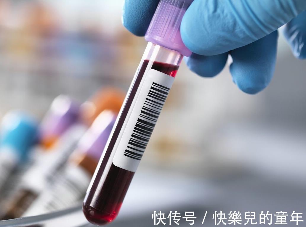 运动|102岁长寿老人，年轻像60岁，秘诀不是多运动，而是这3件事