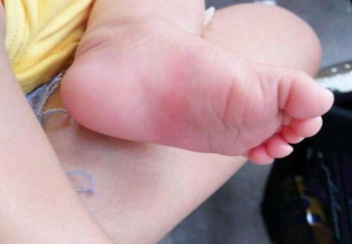 开关|孩子自带3个“聪明开关”,常摸可以提高智商,多数父母都不知道