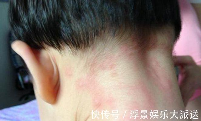 孩子|孩子哭着说身上痒,母亲掀开床垫清理,结果发现一物想要呕吐