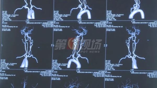 张红鸭|全身换血！男子手脚“软趴趴”9年，在深圳找回了“力量”…