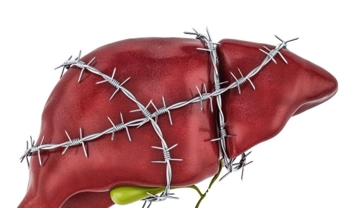 蔬菜|98岁吴院士提醒：肝不好的人，少吃这3种蔬菜，肝脏或感激你