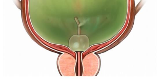 黄豆|前列腺炎不能吃黄豆？不止是黄豆，这4种食物也要敬而远之