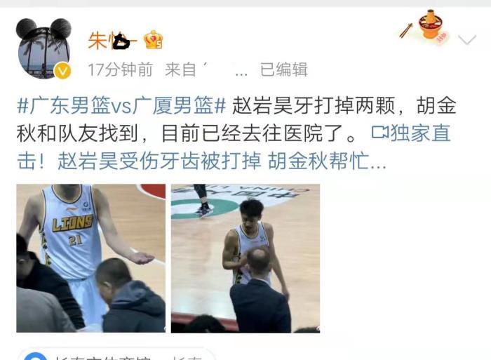 杜导|CBA广厦大胜广东!孙铭徽暴怒找曾繁日算账!随后赵岩昊牙就掉了