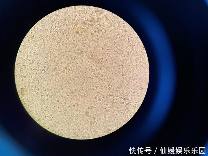 4岁孩子连着狂吐两天还水米不进，最后医生在便便里找到这种虫子