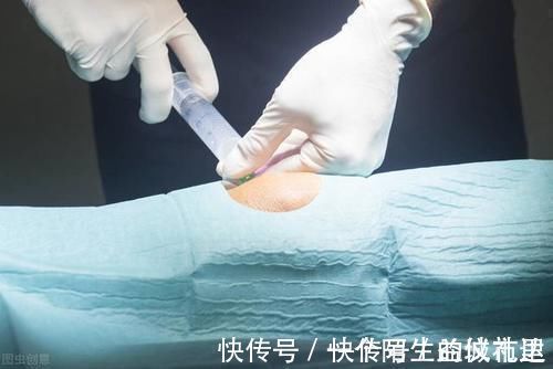 关节|得了膝关节炎,打玻璃酸钠到底管不管用?骨科医生告诉你答案