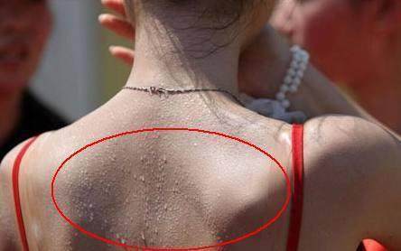 盗汗者|动不动出一身汗不要认为天气热,是身体两个部位发出的求救信号