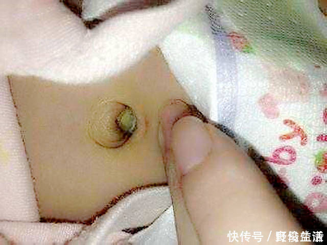 王女士|新生儿患上败血症,只因妈妈这个小动作,网友怎么狠心下得了手