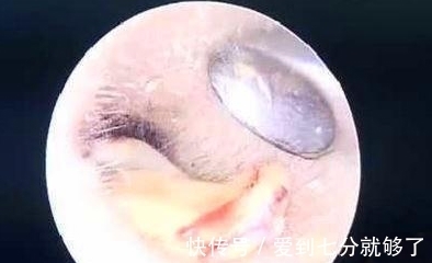 小陈|儿子耳朵不舒服,女子带他去医院检查,没想到耳朵里竟发芽了