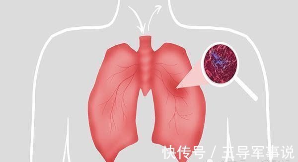 检查|肺部有结节，睡眠告知，睡觉时老有异常表现，是肺在向你求救