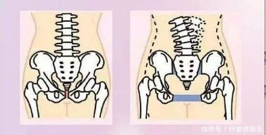 疼痛|孕晚期难熬的“彻骨之痛”,最爱找四类孕妈,看看其中有没有你