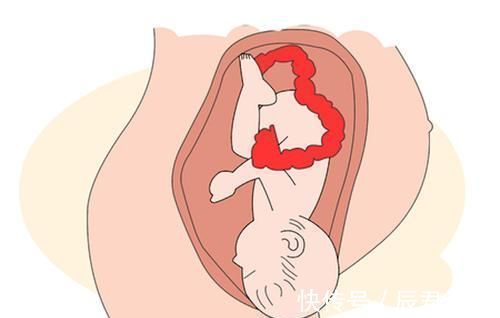 骨盆|顺产时,宝宝是靠自己的力气爬出来的,还是妈妈挤出来的