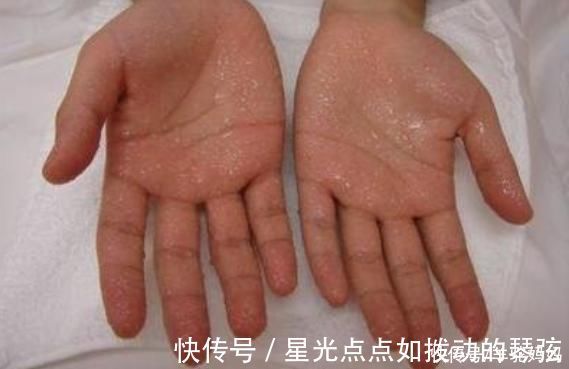 脾胃|“脾胃虚”的宝宝,身上这2个部位经常出汗,父母早了解娃早受益