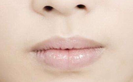 嘴巴|女人嘴巴上若有5个表现,多半是妇科病缠身,不妨了解下