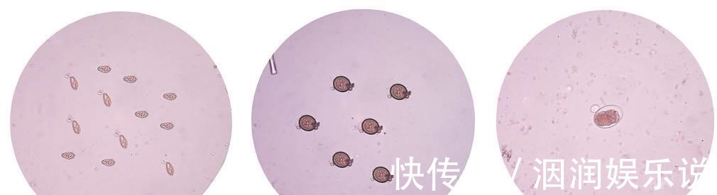 宝塔糖|为什么以前农村小孩每年要吃打虫药，现在却少有人吃了