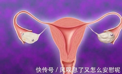 瘤子|子宫肌瘤一定要做手术吗?有3种情况可以不用做手术