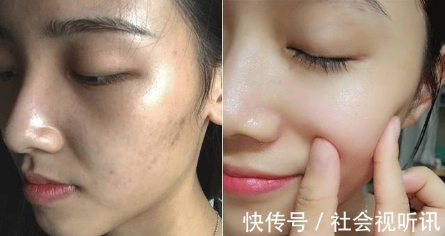 爽肤水|精华液直接就往脸上涂怪不得无效还伤脸,这三点错误一定要注意