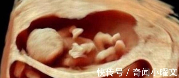 产妇|国外48岁高龄产妇怀上龙凤胎,可宝宝出生后,她却觉得天要塌了