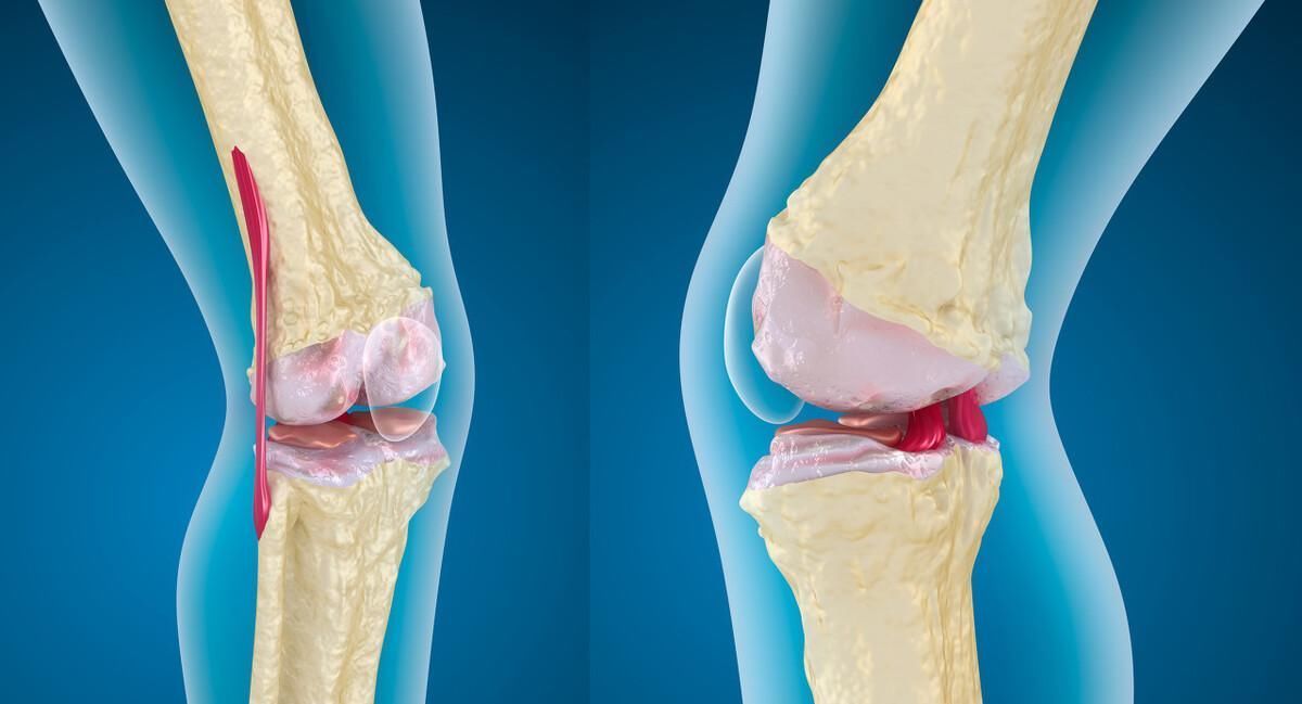 感激涕零|糟蹋骨质的4种行为,若1个没有,骨骼将会感激涕零
