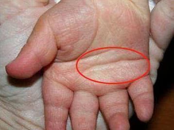 智商|孩子将来是否聪明,看看小手就知道,智商高低在手上就有信号