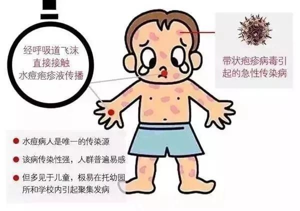  防控|水痘来了，您做好防控了吗？