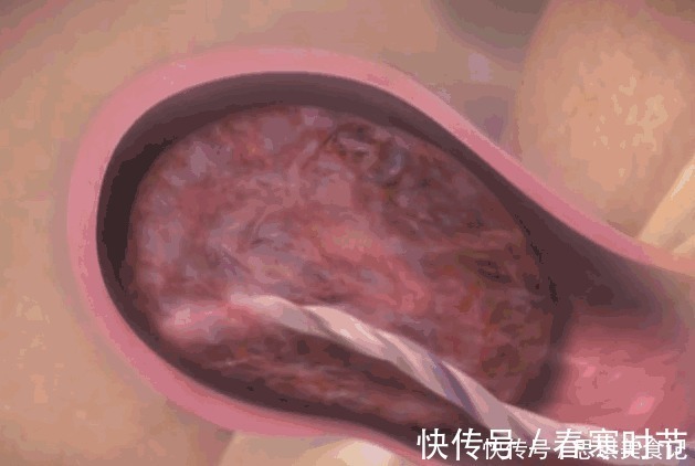 宝宝|生孩子到底有多痛?10张图告诉你:宝宝如何一步步来到这个世界