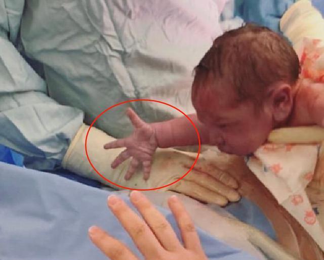 小宝宝|“最社会婴儿”火了,刚出娘胎就急着和妈妈握手,网友直呼:秀儿