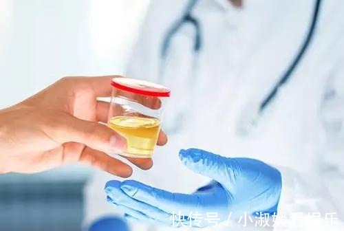 尿液发黄|上厕所时尿液发黄,并伴有一股异味?建议注意下这几个方面