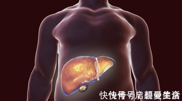 肝病|豆浆是肝病的“发物”?医生提醒:若想肝好,3种早餐尽量少碰