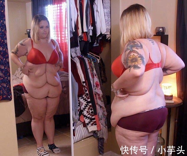 体重|体重580斤的胖妞，成功减肥260斤，松弛的赘肉让她后悔不已！