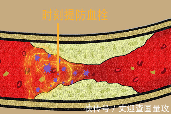 中老年人|50岁之后的人,若没有3种病,往往能长寿,甚至活到九十九