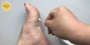 阿司匹林加牙膏,作用好厉害,解决了好多人一大困扰,告知家里人