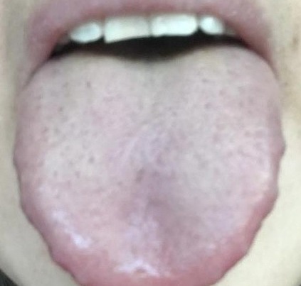 津不上承|老中医告诉你一到晚上就口干口渴的厉害是怎么回事